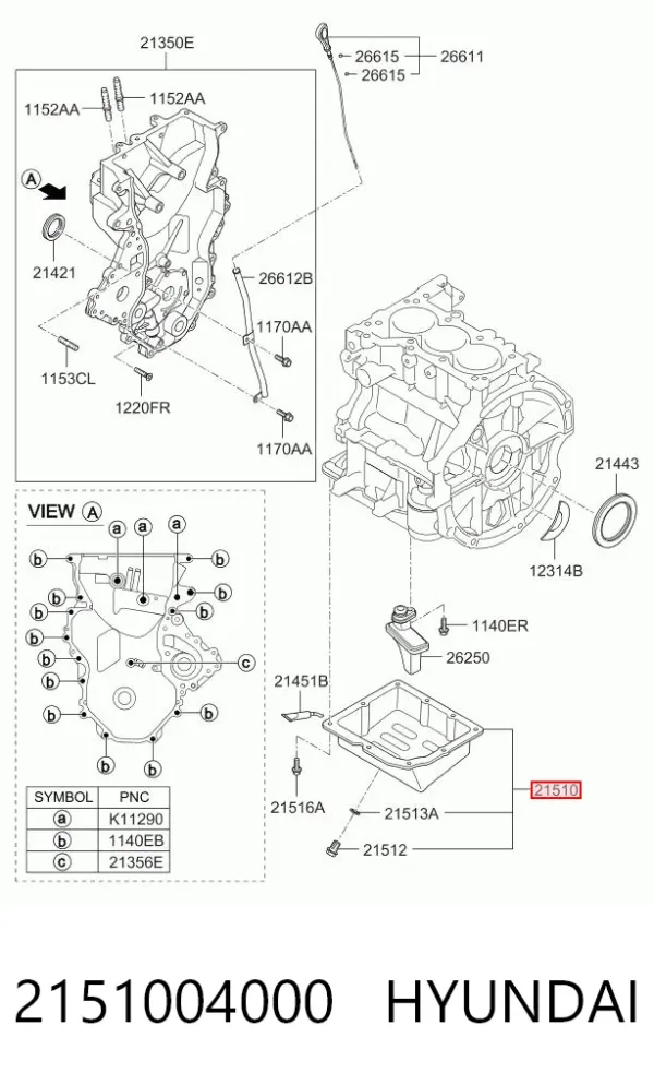 Піддон масляний картера двигуна 2151004000 Hyundai/Kia