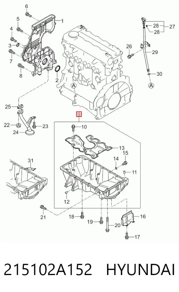 Піддон масляний картера двигуна 215102A152 Hyundai/Kia